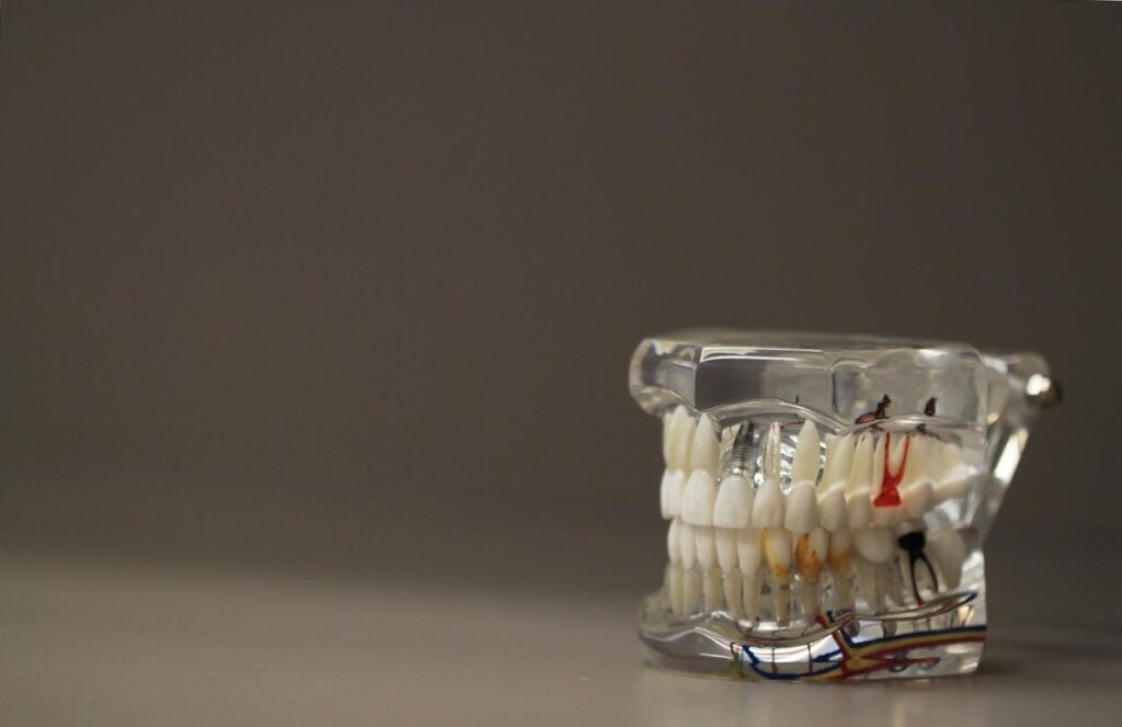 Fogszuvasodás napjainkban: Megelőzés és kezelési lehetőségek